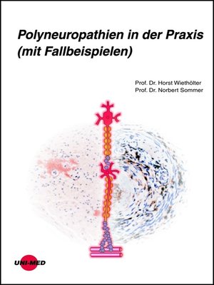cover image of Polyneuropathien in der Praxis (mit Fallbeispielen)